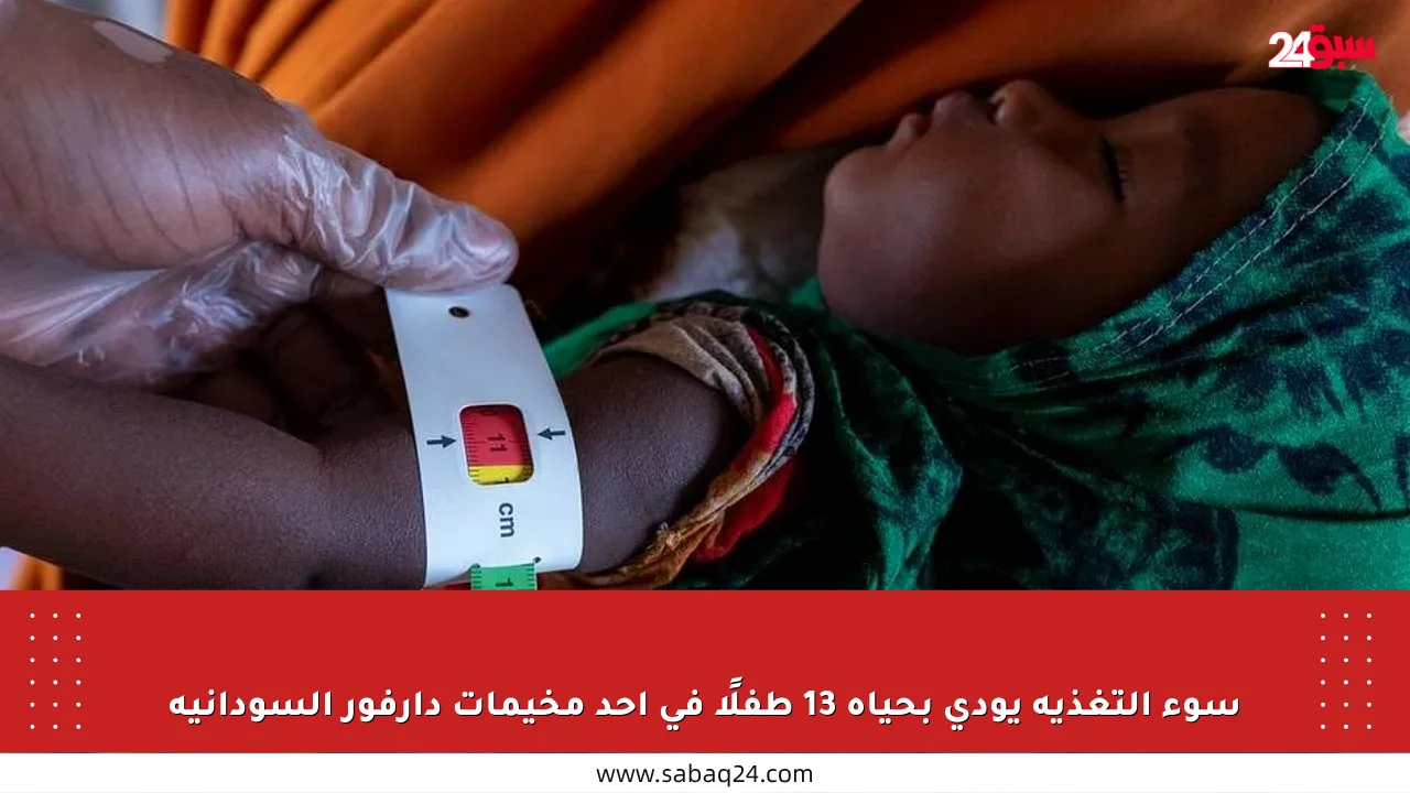 سوء التغذية يودي بحياة 13 طفلًا في أحد مخيمات دارفور السودانية